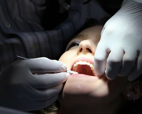 zahnreinigung-dental-repairs-treat-teeth-brushing-teeth
