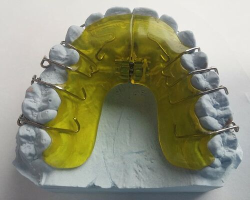 dental-braces-dentist-orthodontics-dental-rail