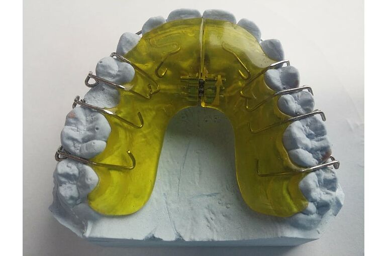 dental-braces-dentist-orthodontics-dental-rail