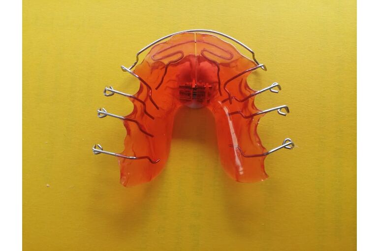 dentist-orthodontics-dental-rail-seemed