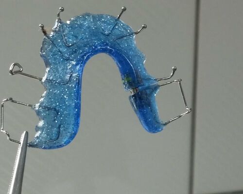 dentist-orthodontics-dental-rail-seemed (1)
