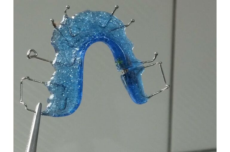 dentist-orthodontics-dental-rail-seemed (1)