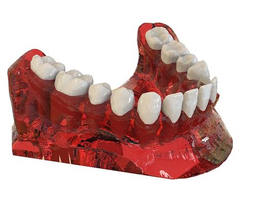 teeth-jaw-3d-model-orthodontics