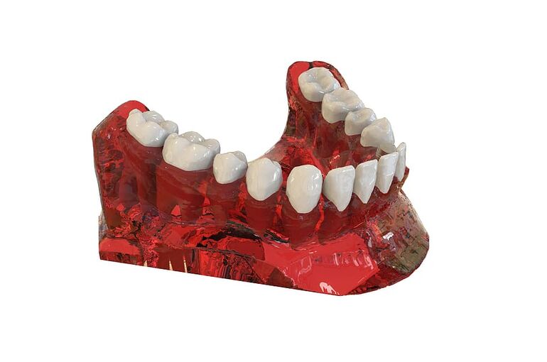 teeth-jaw-3d-model-orthodontics