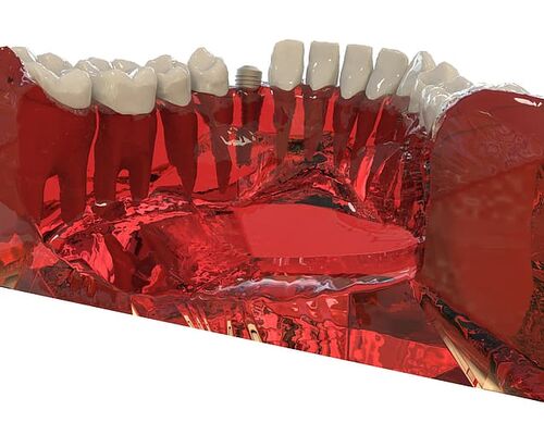 teeth-jaw-3d-model-orthodontics2