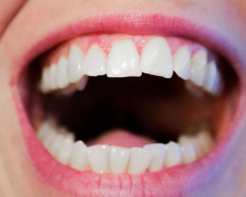 teeth-dentist-dental-mouth