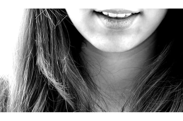 smile-laugh-girl-teeth