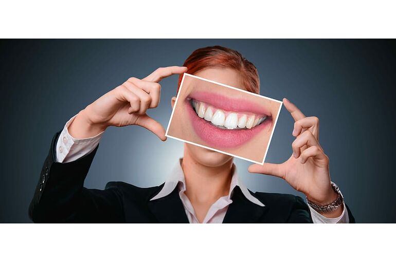 woman-smile-tooth-bless-you