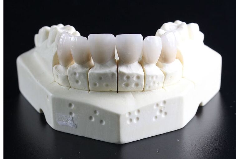tooth-replacement-tooth-dental-technician