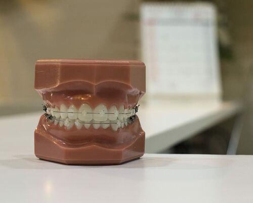 brace-dentist-teeth-wire