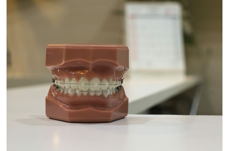 brace-dentist-teeth-wire